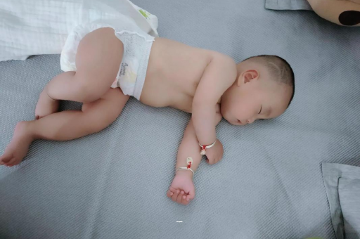 儋州孕妇前庭大腺囊肿